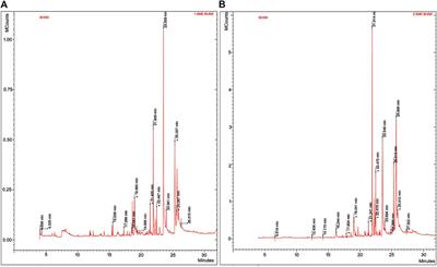 Cytotoxic Potential of Biogenic Zinc Oxide Nanoparticles Synthesized From Swertia chirayita Leaf Extract on Colorectal Cancer Cells